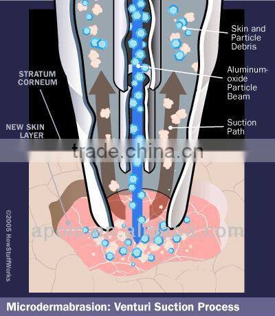 2 in1 Microdermabrasion for skin resurfacing and rejuvenation