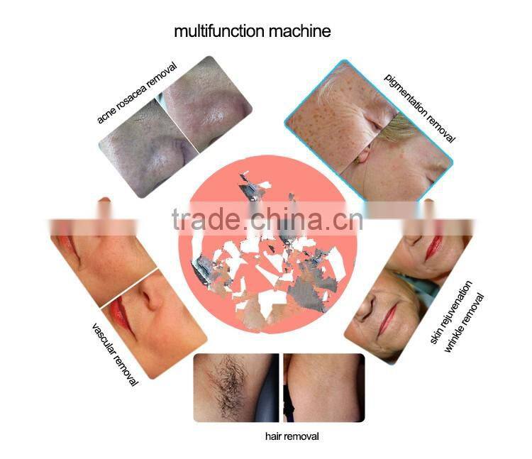 2016 kes newest portable best IPL hair removal machine , E-light