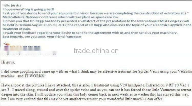 Quickly Natural Weight Loss Tips Perfect Slimming-Velaslim Vacuum Roller Massage Machine