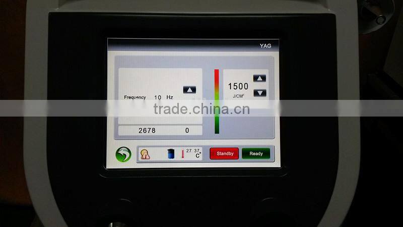 Nd:yag Q-switch pigment arm tattoo removal laser