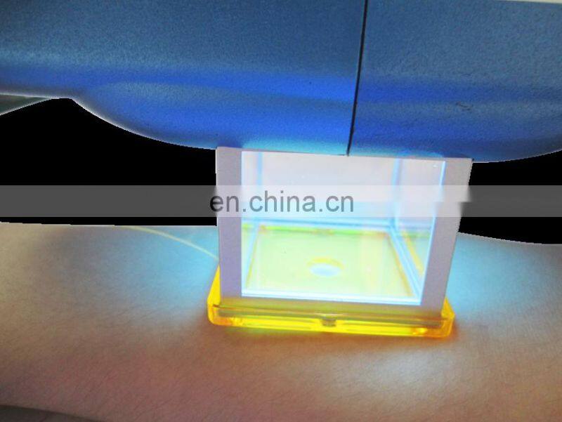 Handheld Excimer Laser 308Nm Psoriasis Vitiligo Laser Unit uv lamp vitiligo For Vitiligo Treatment