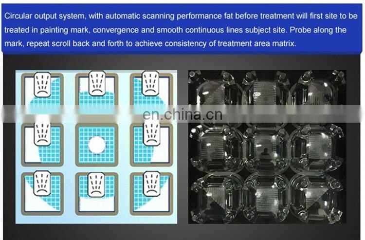 Body Hifu / Liposonic/ hifu Slimming Machine / hifu Beauty Machine