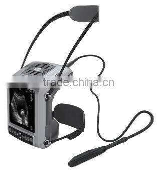 veterinary ultrasound/ultrasound machine for pregnancy ultrasound KX5200