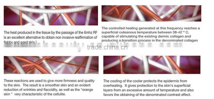 oem odm Safe and Effective Radio Frequency Ultrasonic Cavitation Freeze Fat Reducing Fat Apparatus For Sale