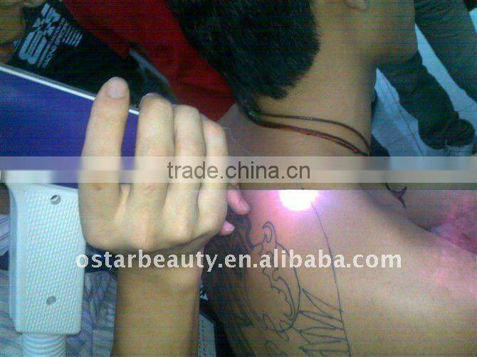 (2013 Hot sales) MINI pigment removal tattoo removal laser machine OB-TR 03