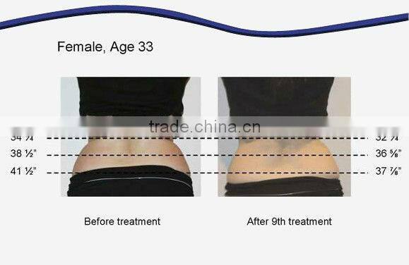 hot selling fitness equipment body slimming machine