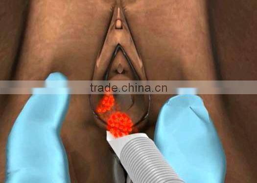 co2 laser power supply Professional fractional co2 laser machine(manufacturer) / fractional laser co2 Vaginal tightening