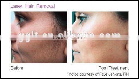 import and export of medical equipment