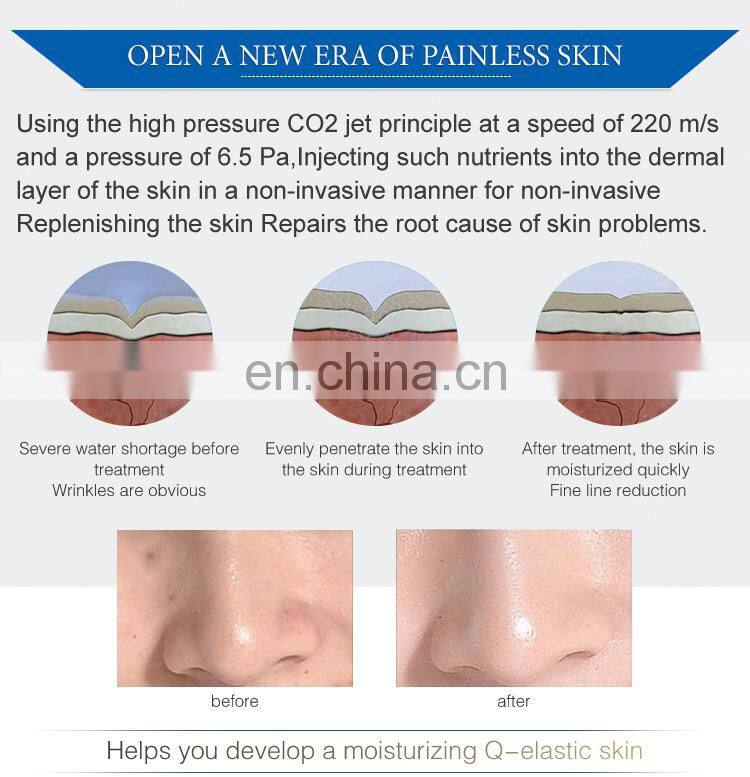 Portable frozen skin CO2 gun for anti-wrinkle machine for facial mesotherapy