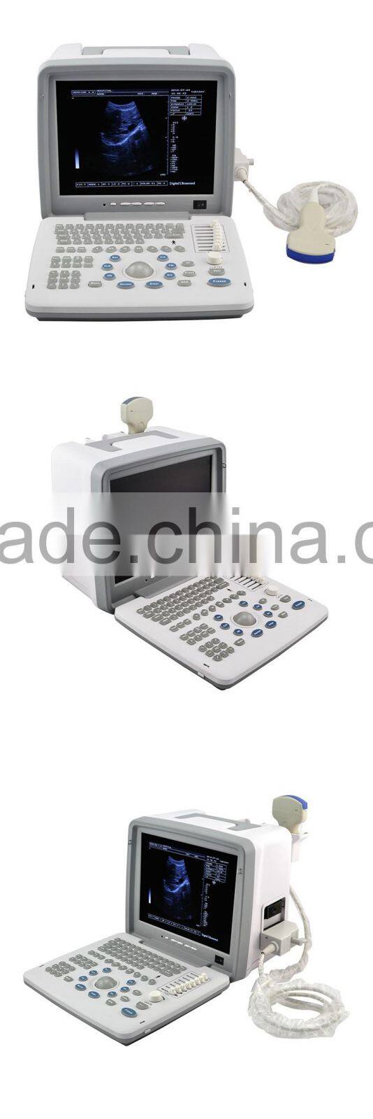 Portable Ultrasound Scanner with Convex probe transvaginal micro-convex rectal probe optional video printer