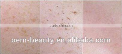 Factory direct sales !! 808nm Diode Laser+IPL diode laser hair removal with CE approved
