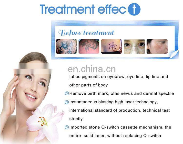 2020 Hot Sale Touch Screen 2000mj Tattoo Removal Laser Machine China Laser ND YAG Laser