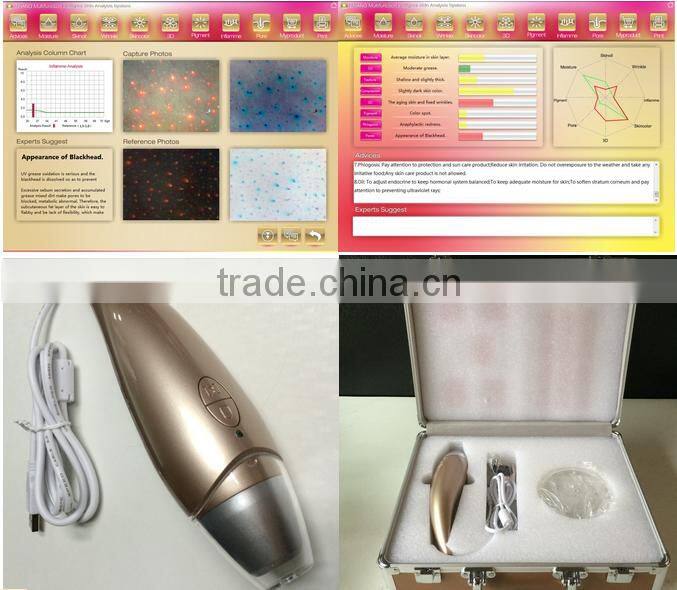AYJ-J016 hot offer skin care 3d skin analyzer beauty deveice