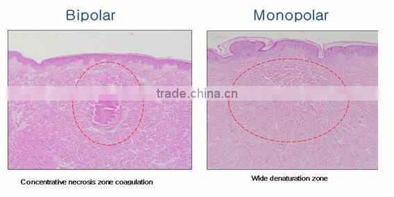 Personal care and beauty series product fractional rf skin lifting machine