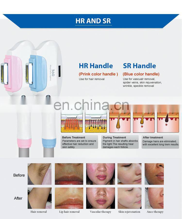 Multi-function 4 in 1 SHR ND YAG laser +RF Skin rejuvenation hair removal tattoo removal beauty machine