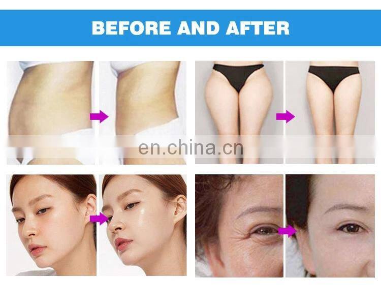 Multifunctional 6 in 1 Portable V10 cavitation vacuum roller body shape slimming cellulite removal machine
