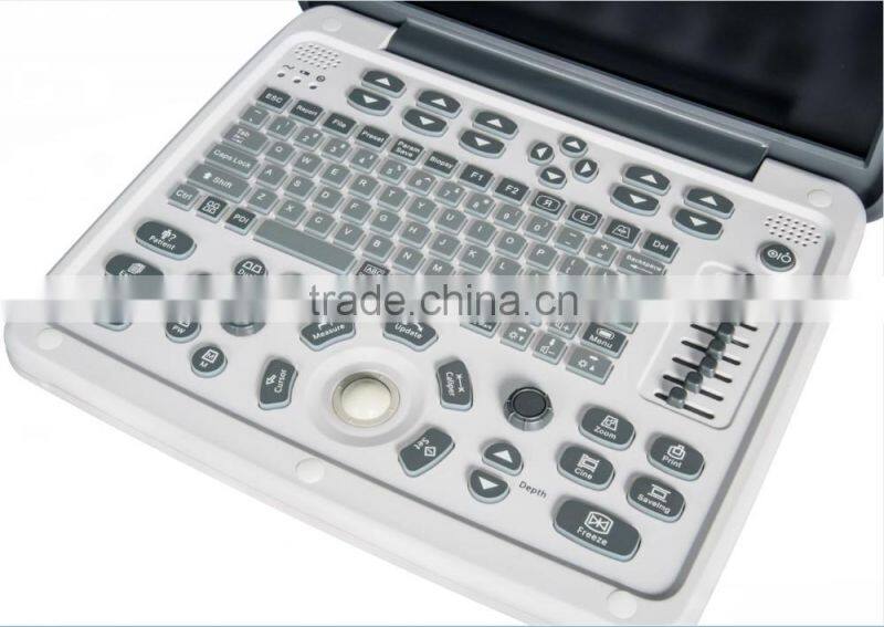 factory SUPPLY portablolor ultrasound machines/ultrasound scanner CE approval doppler ultrasound scanner