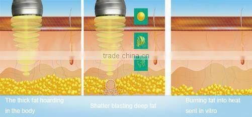 Ultrasonic cavitation slimming machine / RF liposuction Vacuum Machine With 4 Probes