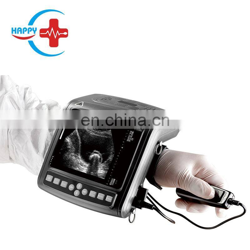 VET-A020V Livestock Digital Vet ultrasound scanner/Portable Cattle Ultrasound Machine