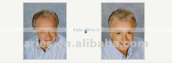 Super Durable Thin Skin toupee Fast Delivery