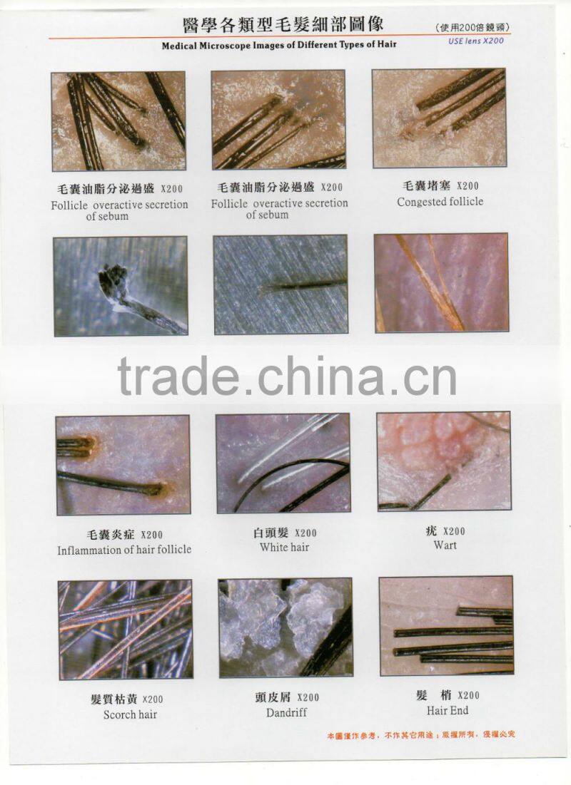 AYJ-J015 skin analyzer magnifier machine/skin analysis machine/2015 CE approved best professional skin analysis machine