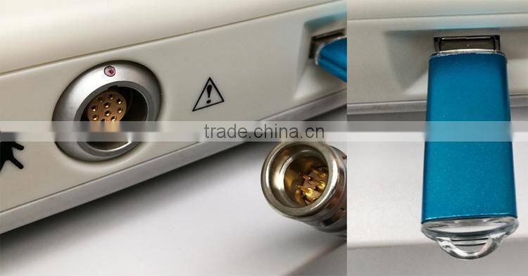 Popular HIFU wrinkle removal and skin tightening beauty equipment