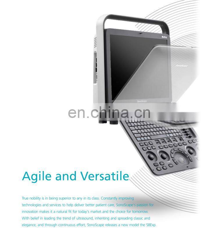 Professional 4D Color Doppler Sonoscape ultrasound scanner/Portable Sonoscape S8 EXP/Sonoscape ultrasound