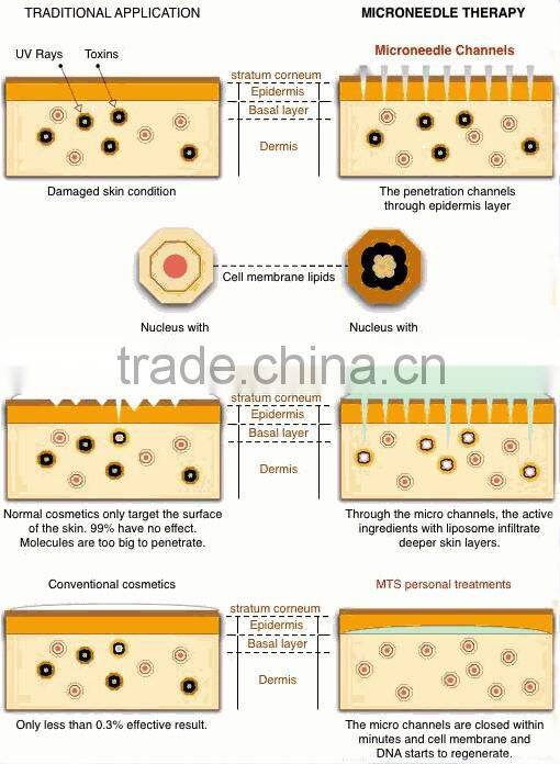 CE and RoHS korea Titanium 300&720 &1200 pins Bionic galvanic Skin nurse wrinkles eliminate derma roller