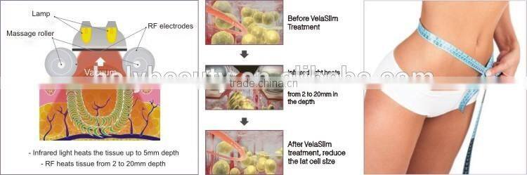 Power Shaper !! Vaser Shape Machine Vaser Shape