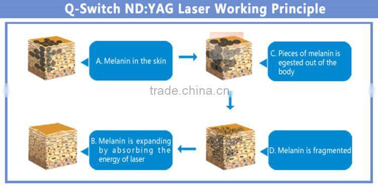 Touched screen q switch nd yag laser machine with Japan imported yag laser lamps