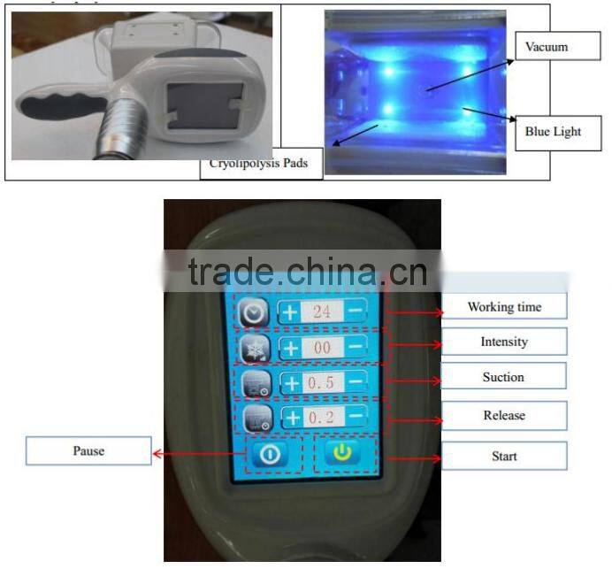 Cryolipolyse fat freezing,cryolipolyse cavitation rf,cryolipolyse fat freezing machine