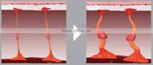 Lipo Cavitation Vacuum Slim Belly