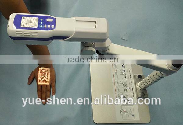 medical LED portable vein viewer