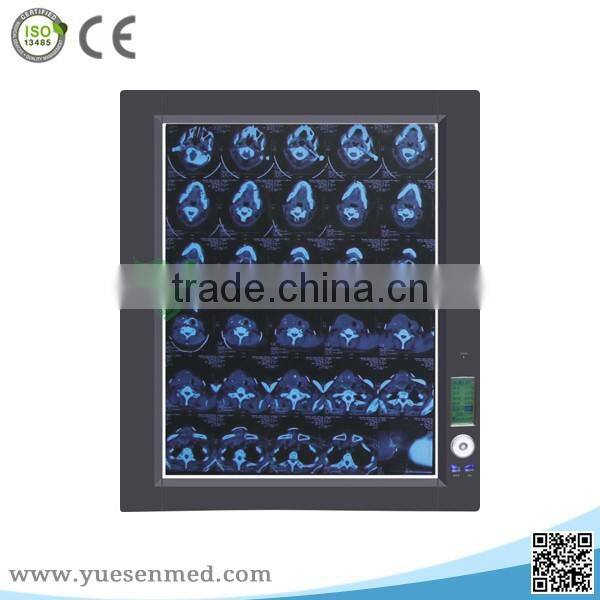 YSX1704 Cheapest hot sale medical LED radiography film viewer