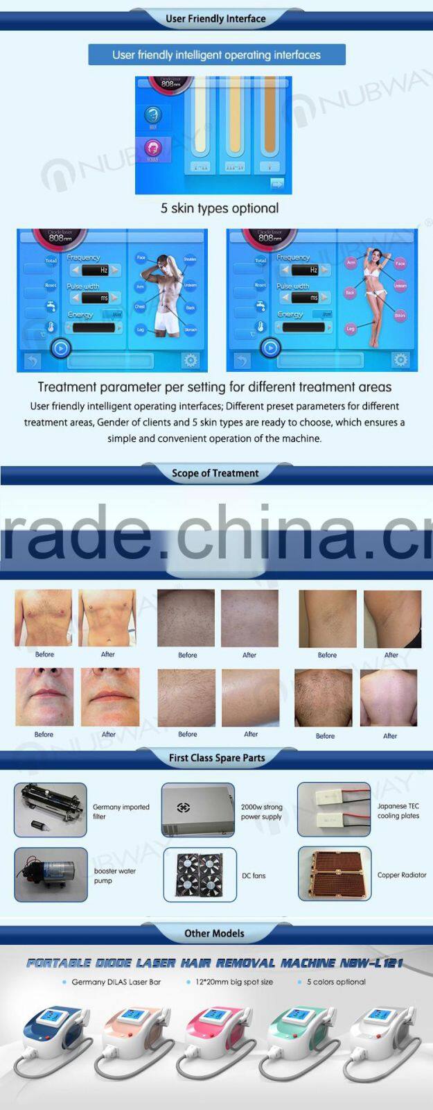 10.4 Inch touch color screen high power professional and effective permanent unhairing portable 808nm diode laser