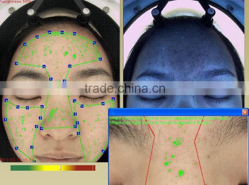 Facial skin moisture oil analyser/Skin Moisture Tester