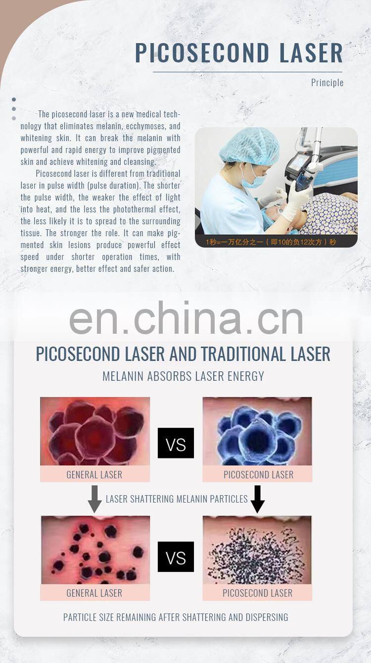 hot sale 7 joint articulated arm 755nm nd yag picosecond laser machine