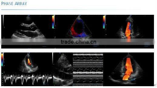 3D and 4D Color Doppler with 4D Real Time Live Probe iSpark 480plus/option Trans-vaginal Array Probe (180)