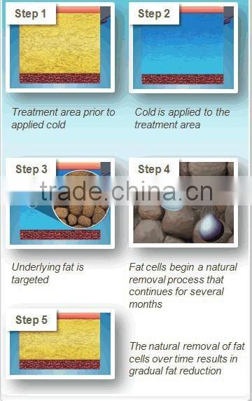 Advanced Vacuum Cryolipolysis Professional CE Two Handles Cryo Fat Freeze Slimming Beauty Machine