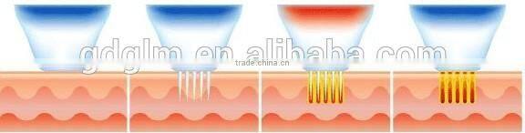 Newest! Fractional RF Microneedle RF skin tightening system(F-018)