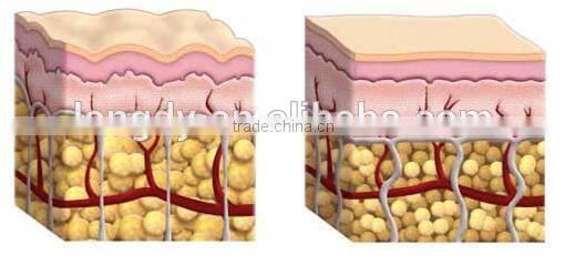 multifunction home use beauty machine for clean face, anti-aging, wrinkle removal