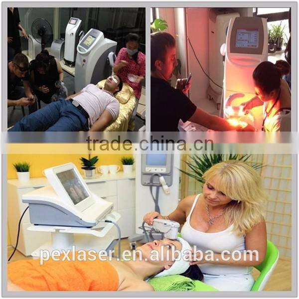 ND yag q-switched laser tattoo removal machine/1064nm