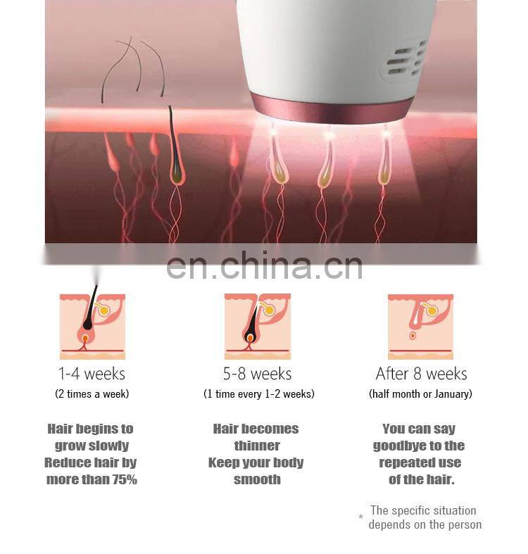 epilator home laser hair removal handheld 808nm diode laser hair removal machine at home