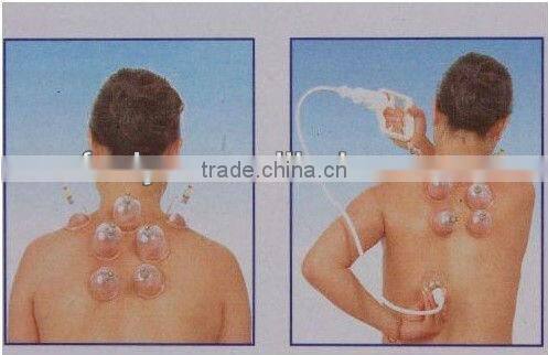 VY-01 Nice and good chinese cupping set for health care in