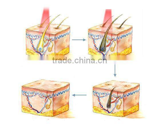 Hot selling IPL/SHR SSR hair removal skin rejuvenation beauty machine