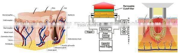 16X57 sapphire crystal best professional ipl machine for hair removal