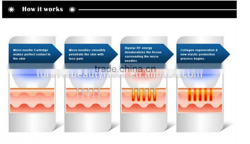 Microneedle fractional radio frequency machine-MNF100 promotion price on sale