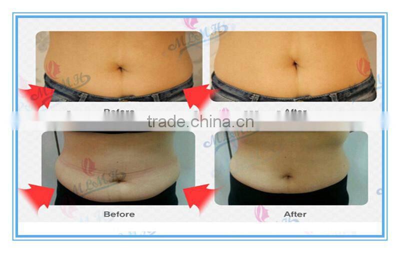 AICHUN slim cream products herbal fat burning slim cream 200ML with hot chili