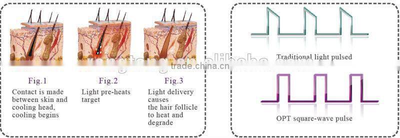 2015 Cooling handle laser hair removal machine approved SPT FCA Technology ICE SHR SSR machine