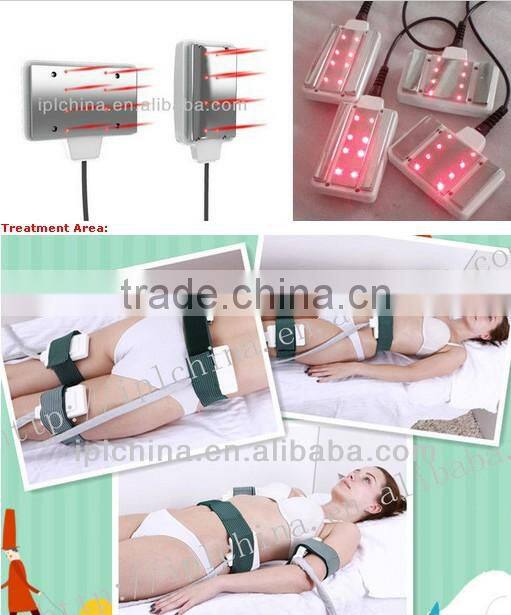 Portable Cyclone RF Slim Vacuum Cryo Liposuction Machine -Cyclone Shape